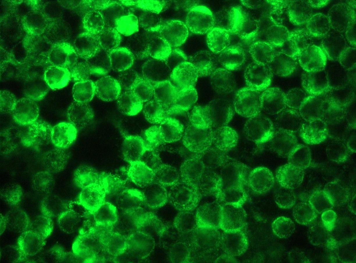 Figure 1. Indirect immunofluorescence staining of reticulons-1A and 1B (NSP-A and NSP-B) in methanol fixed H82 small cell lung cancer cells using MUB1314P (RNL-3; diluted 1:500).